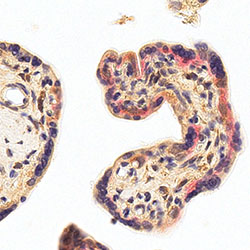 sars-cov-2 gene expression in a human fetus